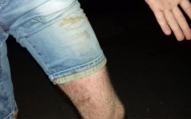 На Чкалова мужчина провалился в люк Фото № 3 На Чкалова мужчина провалился в люк Фото № 3
