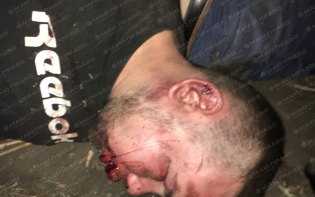 Полиция задержала преступную банду, пытавшуюся сжечь дом фермера с его женой и двумя детьми (фото 18+) Фото № 6 Полиция задержала преступную банду, пытавшуюся сжечь дом фермера с его женой и двумя детьми (фото 18+) Фото № 6