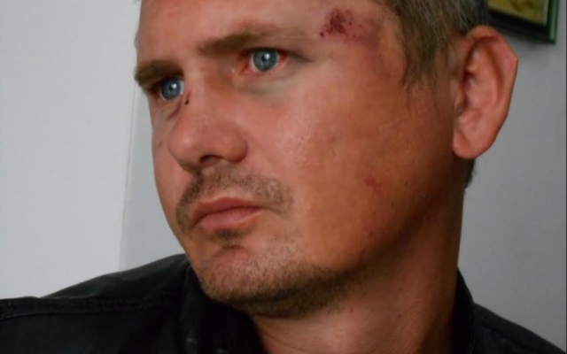 Активист пострадал от рук депутата сельсовета Фото № 0 Активист пострадал от рук депутата сельсовета Фото № 0