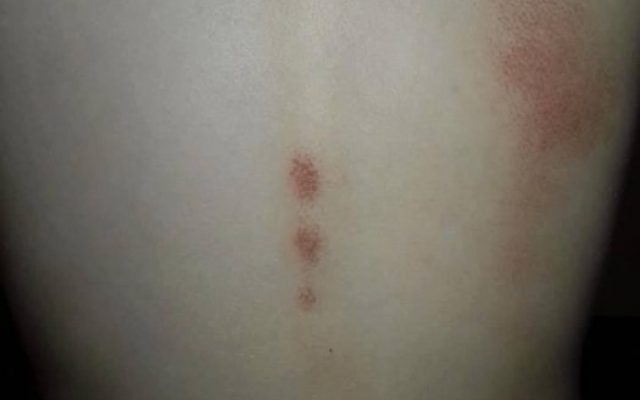 Женщина забрала сына из детского сада с кровоподтеками и ссадинами, воспитатели разводят руками Фото № 0 Женщина забрала сына из детского сада с кровоподтеками и ссадинами, воспитатели разводят руками Фото № 0