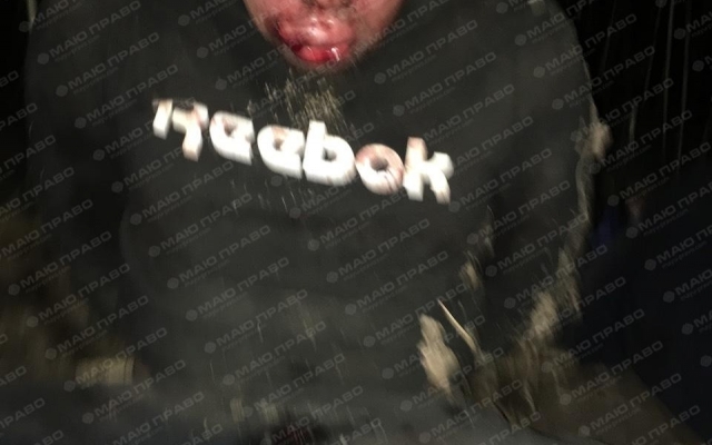 Полиция задержала преступную банду, пытавшуюся сжечь дом фермера с его женой и двумя детьми (фото 18+) Фото № 5 Полиция задержала преступную банду, пытавшуюся сжечь дом фермера с его женой и двумя детьми (фото 18+) Фото № 5