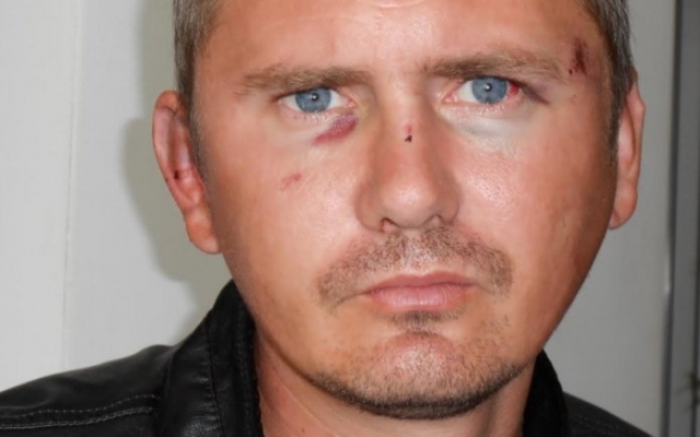 Активист пострадал от рук депутата сельсовета Фото № 1 Активист пострадал от рук депутата сельсовета Фото № 1