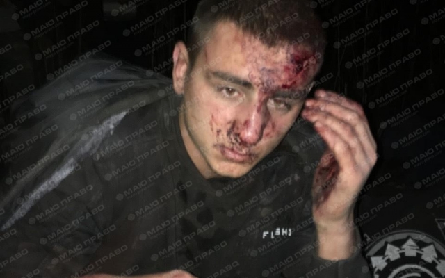 Полиция задержала преступную банду, пытавшуюся сжечь дом фермера с его женой и двумя детьми (фото 18+) Фото № 2 Полиция задержала преступную банду, пытавшуюся сжечь дом фермера с его женой и двумя детьми (фото 18+) Фото № 2