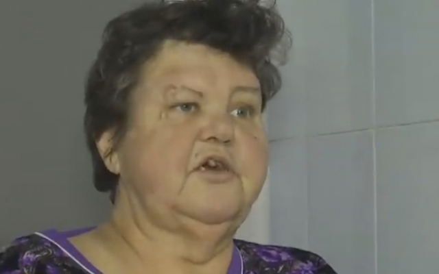 В Николаевской области из-за врачебной ошибки женщина осталась без ноги Фото № 0 В Николаевской области из-за врачебной ошибки женщина осталась без ноги Фото № 0