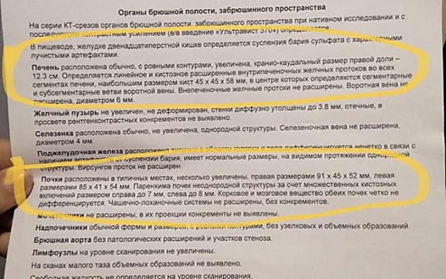Маленькая дочь николаевского полицейского срочно нуждается в помощи на лечение за границей Фото № 1 Маленькая дочь николаевского полицейского срочно нуждается в помощи на лечение за границей Фото № 1