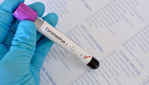 В Николаеве еще 16 человек заболели COVID-19 за последние сутки Фото № 0 В Николаеве еще 16 человек заболели COVID-19 за последние сутки Фото № 0