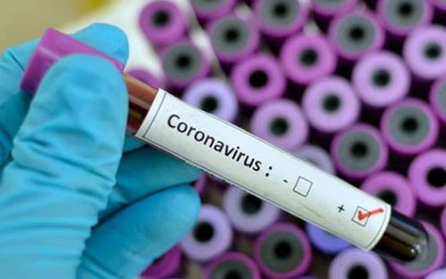 В Николаевской области +11 новых случаев коронавируса: вспышку заболеваемости зафиксировали в Южноукраинске Фото № 0 В Николаевской области +11 новых случаев коронавируса: вспышку заболеваемости зафиксировали в Южноукраинске Фото № 0