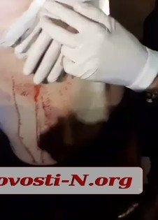 В результате конфликта возле гостиницы «Турист» ножевое ранение получил таксист Фото № 1 В результате конфликта возле гостиницы «Турист» ножевое ранение получил таксист Фото № 1