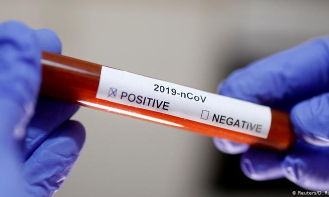 8 областей уже получили тесты на коронавирус, Николаев — пока нет