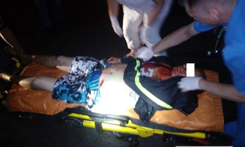 В результате ночной драки николаевец получил тяжелое ножевое ранение