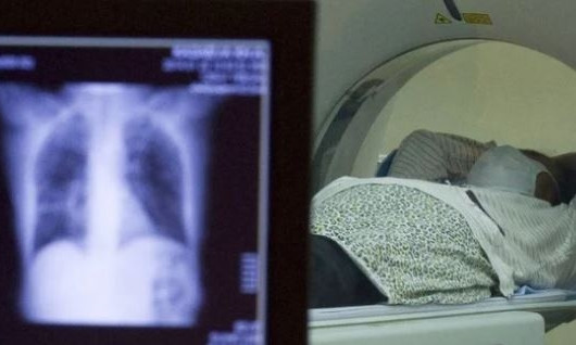 Обследование на компьютерном томографе для больных коронавирусом не предусмотрено в Николаеве 