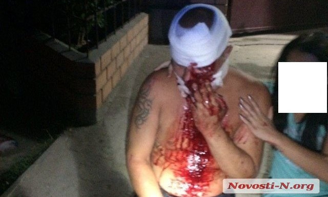 Ночная драка в Николаеве: мужчине проломили голову бутылкой