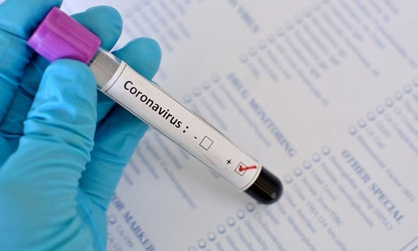 Повторное расследование по делу николаевского семейного врача, погибшей от коронавируса, завершилось 