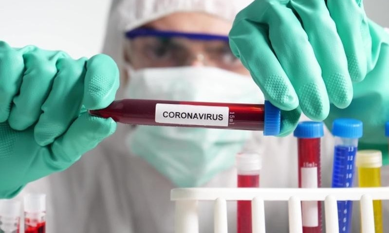 «В этом нет необходимости», - Владимир Клочко о массовом тестировании на коронавирус