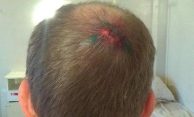 В Одессе брат бывшего николаевского прокурора проломил голову прохожему из-за замечания