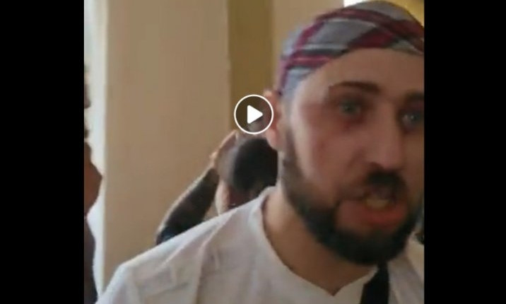 В Николаевской мэрии зоозащитница покусала активиста и чуть не выцарапала ему глаз