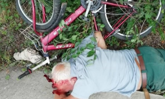 В Южноукраинске полицейские обнаружили в кювете пожилого мужчину с проломленной головой и без сознания (фото 18+)