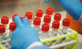 В Николаеве в лаборатории готовы проводить ежедневно до 500 исследований на коронавирус